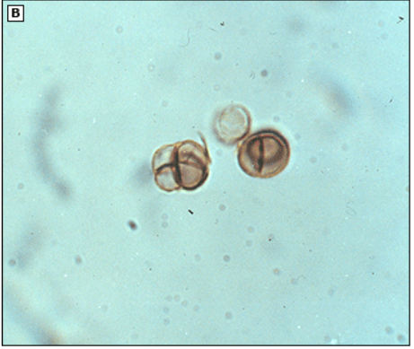 muriform cell